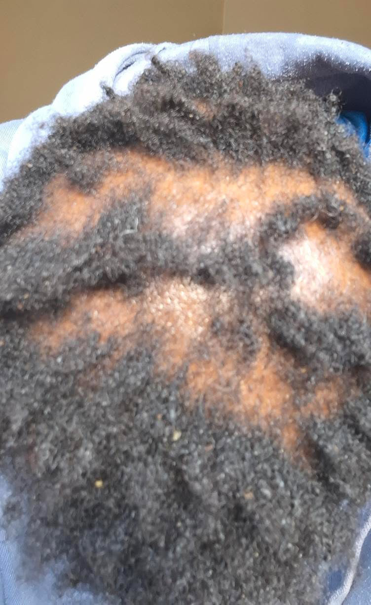 Before