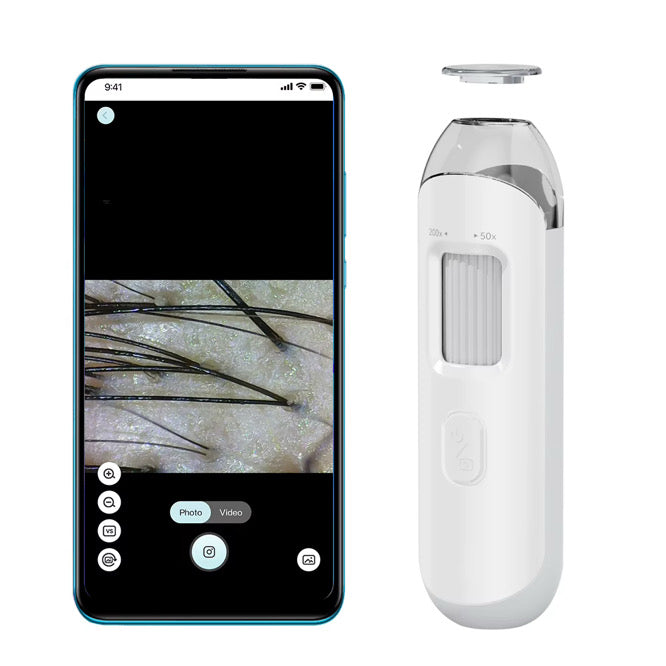 Scalp & hair analyzer